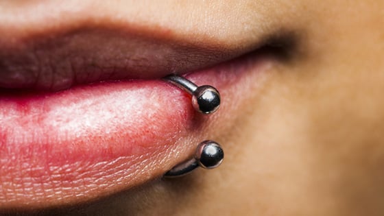 Oral Piercing Infection